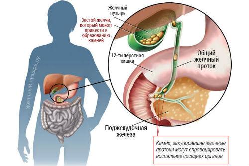 Застой желчи — боль в сердце и суставах