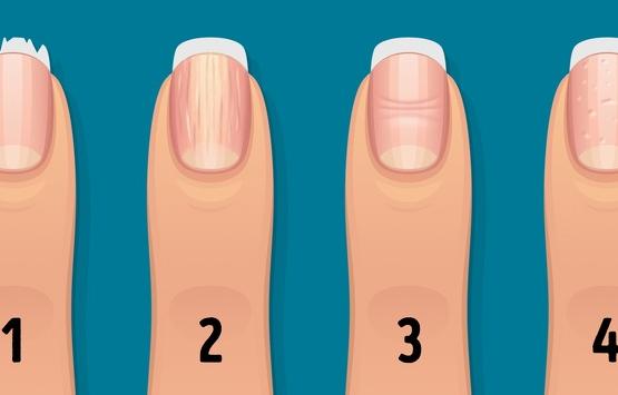 16 Things Your Nails Can Say About Your Health