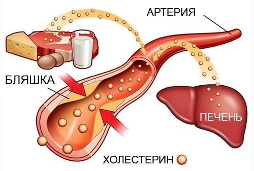 Питание для здоровья ваших артерий