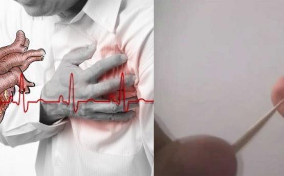 Եթե սրտի նոպա եք ունենում շուտ ասեղով կամ այլ հարամարանքվ ծակեք ձեր մատը