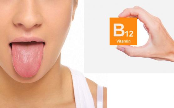 Սա նշանակում է, որ ձեր B12 վիտամինի պակաս կա