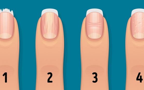 16 Things Your Nails Can Say About Your Health