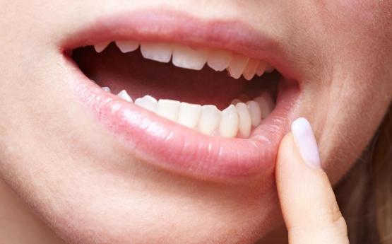 Ինչ հիվանդության նշան է, եթե ատամները հաճախ փչանում են, կոտրվում և կարիես առաջանում