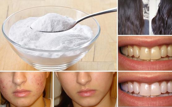Սոդայի օգնությամբ սպիտակեցրեք ատամները և վերացրեք դեմքի պզուկներն ու մազերի շերտավորվածությունը  