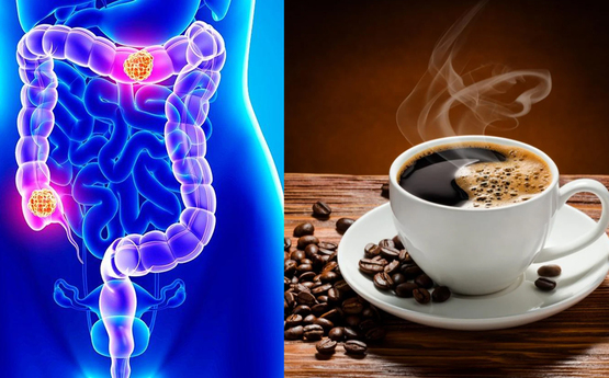 Ինչպես է սուրճը ազդում աղիների վրա․ Իմացեք այս մասին, նոր սուրճ խմեք