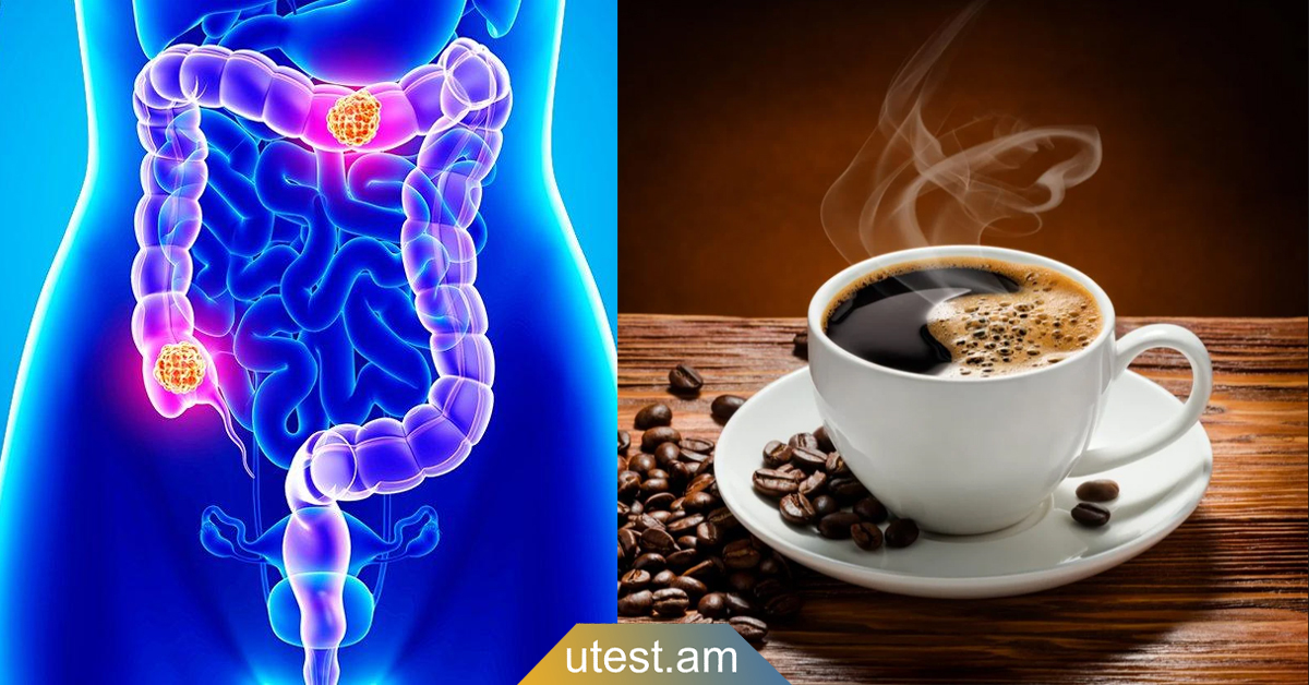 Ինչպես է սուրճը ազդում աղիների վրա․ Իմացեք այս մասին, նոր սուրճ խմեք